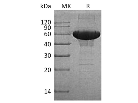 Recombinant Human MMP-3 Protein (His Tag) - ABMIUM