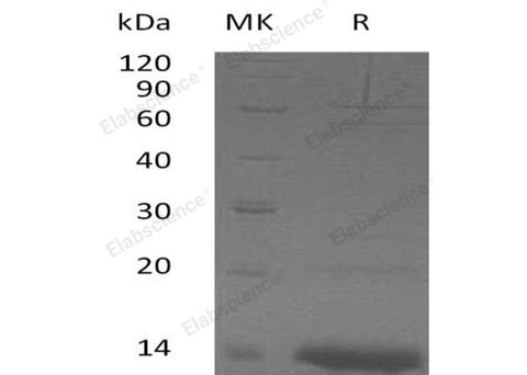 Recombinant Human ZNF75A Protein (His Tag) - ABMIUM