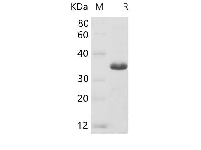 SDS-PAGE analysis of Human GAPDH proteins, 2 μg/lane of Recombinant Human GAPDH proteins was resolved with SDS-PAGE under reducing conditions, showing bands at 34-37 kDa.