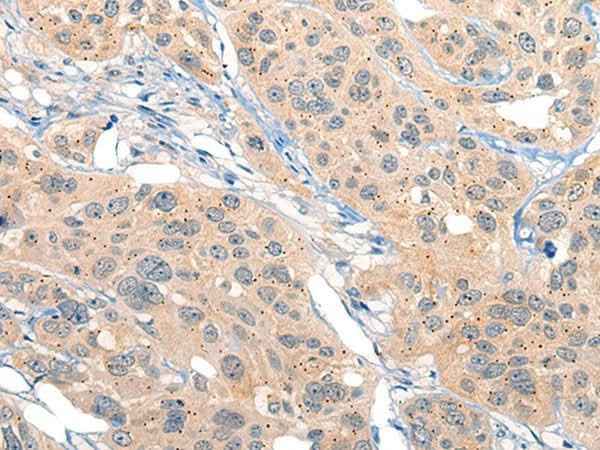 Anti-Human MIIP Antibody