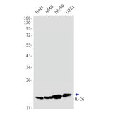 Western blot detection of IL-26 in Hela,A549,HL-60,U251 cell lysates using IL-26 Rabbit mAb(1:1000 diluted).Predicted band size:20kDa.Observed band size:20kDa.