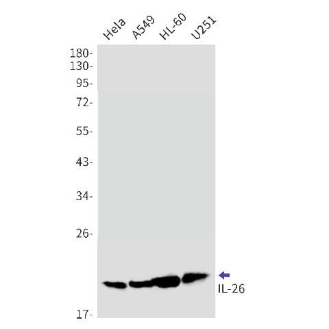 Western blot detection of IL-26 in Hela,A549,HL-60,U251 cell lysates using IL-26 Rabbit mAb(1:1000 diluted).Predicted band size:20kDa.Observed band size:20kDa.