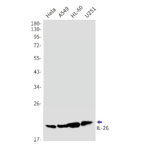 Western blot detection of IL-26 in Hela,A549,HL-60,U251 cell lysates using IL-26 Rabbit mAb(1:1000 diluted).Predicted band size:20kDa.Observed band size:20kDa.