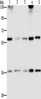 Anti-Human/Mouse STK3/STK4 Antibody - ABMIUM