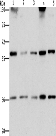 Anti-Human/Mouse STK3/STK4 Antibody - ABMIUM