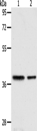 Anti-Human/Mouse/Rat CNN3 Antibody - ABMIUM
