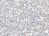 Immunohistochemistry of paraffin-embedded Human tonsil tissue using IFI27 Polyclonal Antibody at dilution of 1:100(×200)