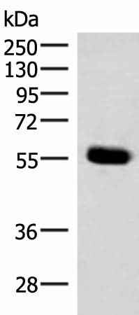 Anti-Human/Mouse/Rat IPPK Antibody