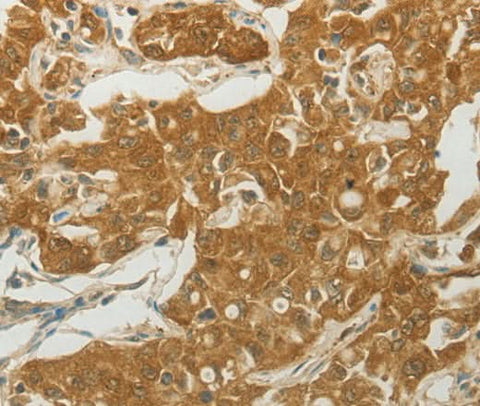 Anti-Human/Mouse MC4R Antibody - ABMIUM