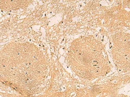 Anti-Human/Mouse/Rat EMC1 Antibody