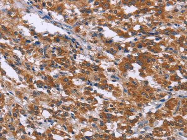 Anti-Human/Mouse SKI Antibody