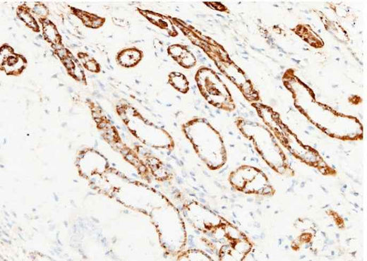 Anti-Human ANPEP Antibody [A1154] - ABMIUM