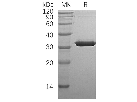 Recombinant Human SULT1A1 Protein (His Tag) - ABMIUM