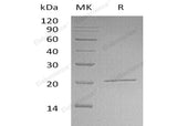 Recombinant Human NIP7/KD93 Protein (His Tag) - ABMIUM