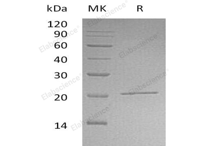Recombinant Human NIP7/KD93 Protein (His Tag) - ABMIUM