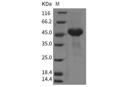 Recombinant Mouse CRELD1 Protein (His Tag) - ABMIUM