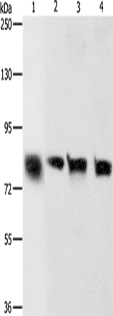 Anti-Human/Mouse/Rat CDH6 Antibody - ABMIUM