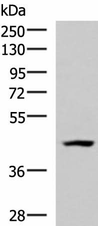 Western blot analysis of 293T cell lysate using MAGEC2 Polyclonal Antibody at dilution of 1:700