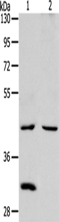 Anti-Human/Mouse/Rat NCEH1 Antibody - ABMIUM