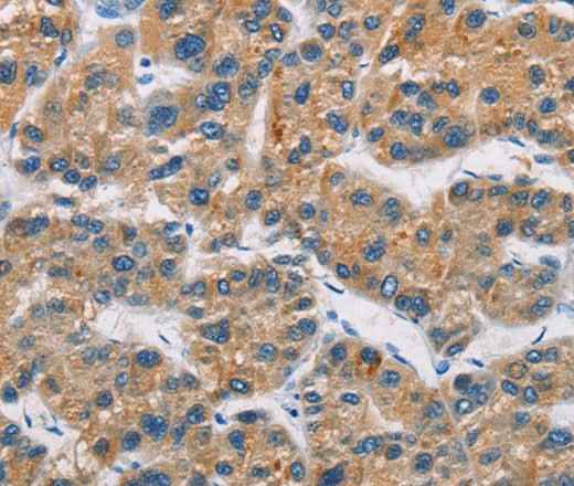 Anti-Human/Mouse CERK Antibody