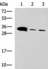 Western blot analysis of Mouse heart tissue Mouse stomach tissue and PC-3 cell lysates using PSCA Polyclonal Antibody at dilution of 1:650