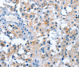 Anti-Human/Mouse/Rat ASB2 Antibody - ABMIUM