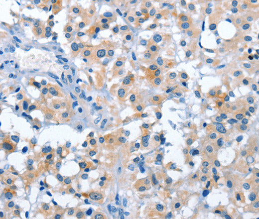 Anti-Human/Mouse/Rat ASB2 Antibody - ABMIUM