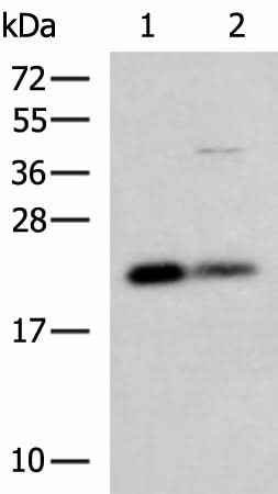 Anti-Human/Mouse/Rat CSRP2 Antibody