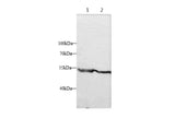 Anti-Human/Mouse/Rat HTRA1 Antibody - ABMIUM
