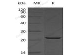 Recombinant Human HSPB2/MKBP Protein (His Tag) - ABMIUM