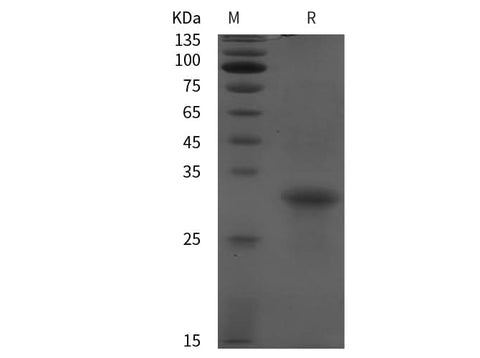 SDS-PAGE analysis of Mouse HP proteins, 2 μg/lane of Recombinant Mouse HP proteins was resolved with SDS-PAGE under reducing conditions, showing bands at 22 kDa.
