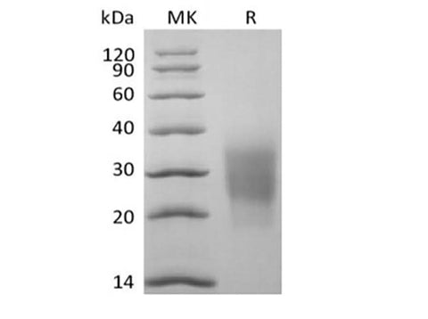 Recombinant Cynomolgus NKG2-D type II Integral Membrane Protein/NKG2D/CD314 (N-6His) - ABMIUM