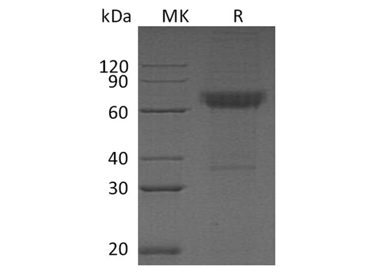 Recombinant Human CD16b/FCGR3B Protein (Fc & His Tag) - ABMIUM
