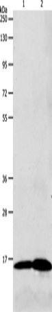Anti-Human LHB Antibody - ABMIUM