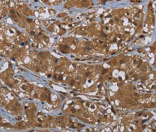 Anti-Human/Mouse/Rat GCK Antibody