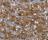 Anti-Human/Mouse/Rat GCK Antibody - ABMIUM