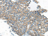Anti-Human/Mouse/Rat CDC42BPA Antibody - ABMIUM