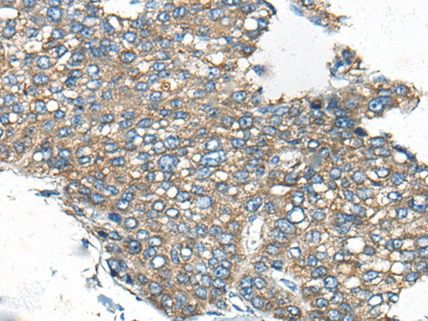 Anti-Human/Mouse/Rat CDC42BPA Antibody - ABMIUM