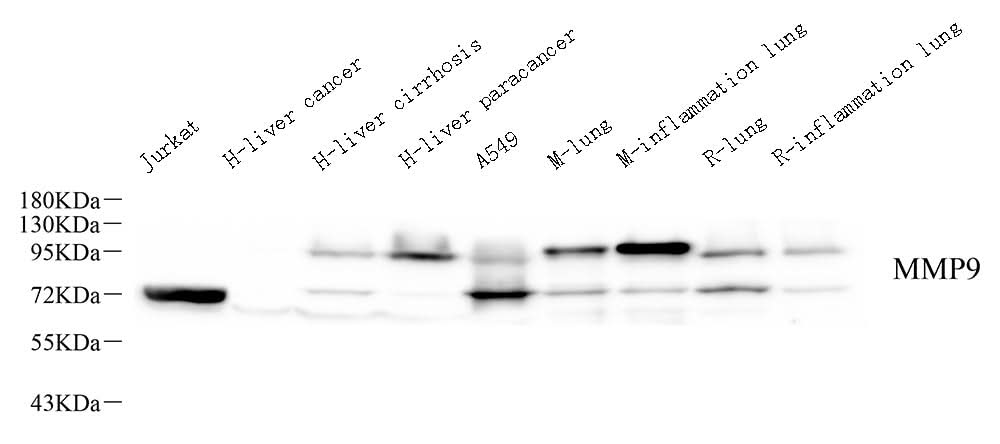 Western Blot analysis of various samples using MMP9 Monoclonal Antibody at dilution of 1:1000.