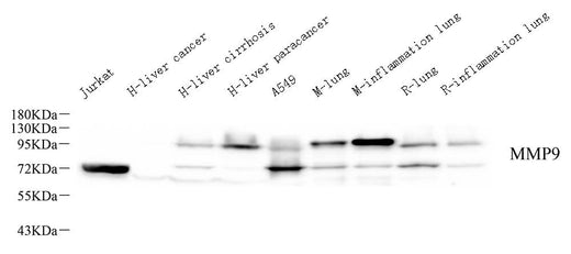 Western Blot analysis of various samples using MMP9 Monoclonal Antibody at dilution of 1:1000.