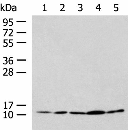 Western blot analysis of HL-60 Hela Jurkat LNCAP HepG2 cell lysates using PAM16 Polyclonal Antibody at dilution of 1:900