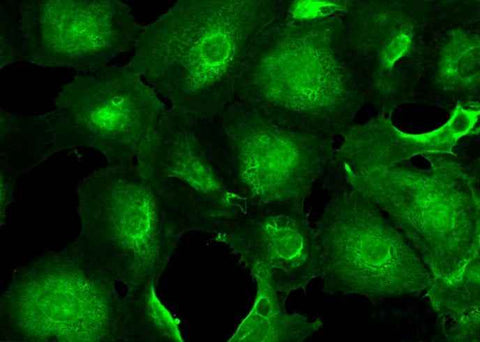 Anti-Human UCHL1 Antibody [A1216] - ABMIUM