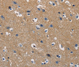 Anti-Human GSTA2 Antibody - ABMIUM