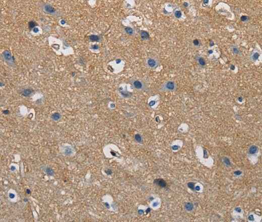Anti-Human GSTA2 Antibody