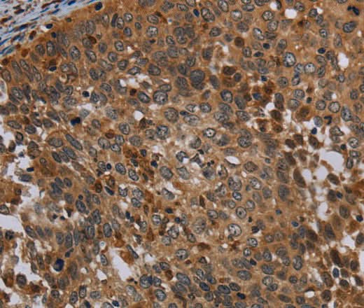 Anti-Human OSM Antibody - ABMIUM
