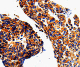 Anti-Human/Mouse/Rat ADD1 Antibody - ABMIUM
