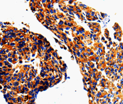 Anti-Human/Mouse/Rat ADD1 Antibody - ABMIUM