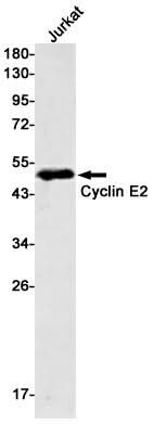 Western blot detection of Cyclin E2 in Jurkat cell lysates using Cyclin E2 Rabbit mAb(1:500 diluted).Predicted band size:47kDa.Observed band size:47kDa.