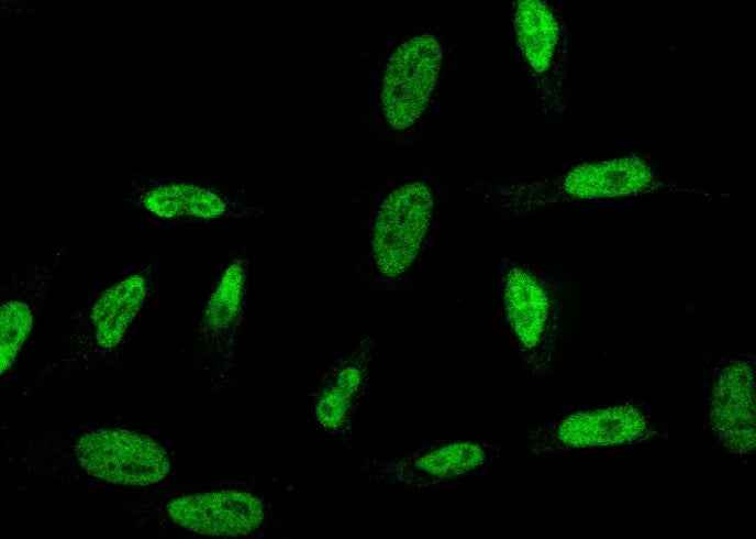 Anti-Human RPRD1B Antibody [A1087] - ABMIUM