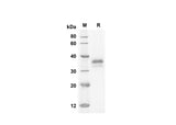 SDS-PAGE analysis of Human IGFBP6 proteins, 2 μg/lane of Recombinant Human IGFBP6 proteins was resolved with SDS-PAGE under reducing conditions, showing bands at 23.3 kDa.